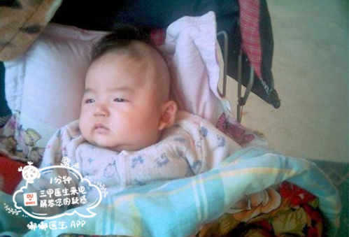 小孩输液为什么会有血,婴儿输液出血了怎么办