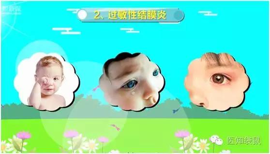 儿童医院专家告诉你：宝宝流眼泪、长眼屎的真相