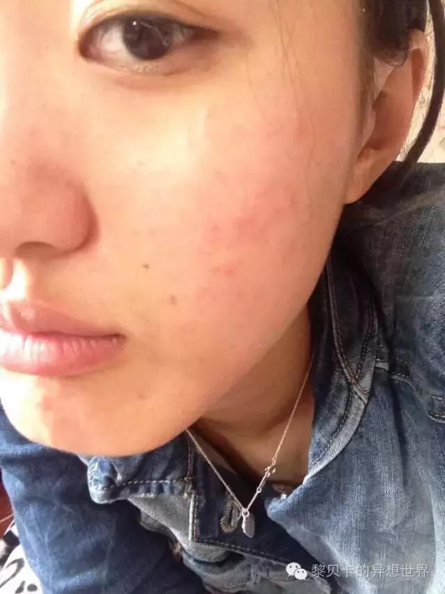 再贵的护肤品都不如男人滋润,再贵的护肤品不如医美