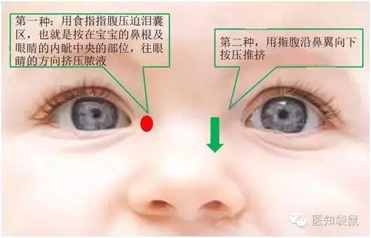 儿童医院专家告诉你：宝宝流眼泪、长眼屎的真相