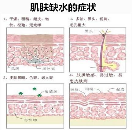 痘痘肌冬天皮肤保湿最好的方法,痘痘敏感肌冬季补水用什么