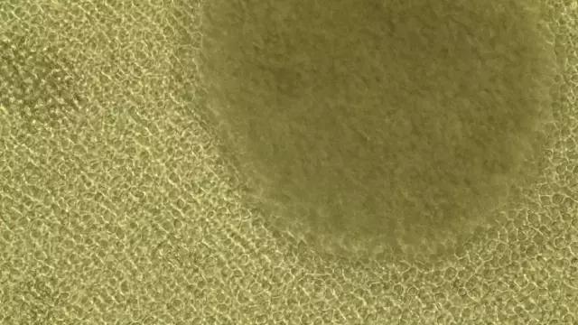 细胞治疗最佳方案,张明徽细胞免疫治疗费用