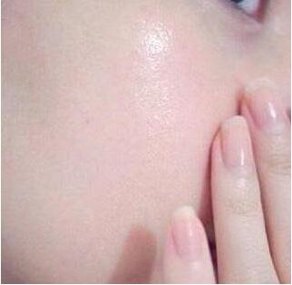 怎么赶走体内黑色素,真正去黑色素的方法