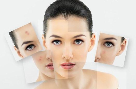 挤痘有刺痛感,挤痘为什么会留痘坑