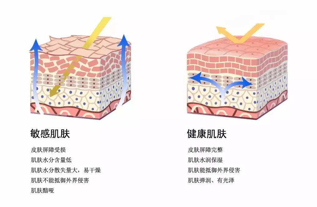 皮肤屏障受损就是敏感肌怎么护肤,屏障受损修复平价护肤产品有用吗