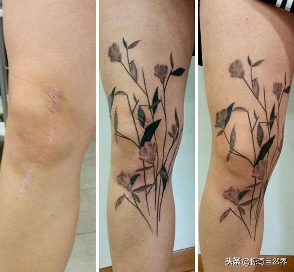 能遮盖疤痕的纹身,遮疤痕的纹身设计