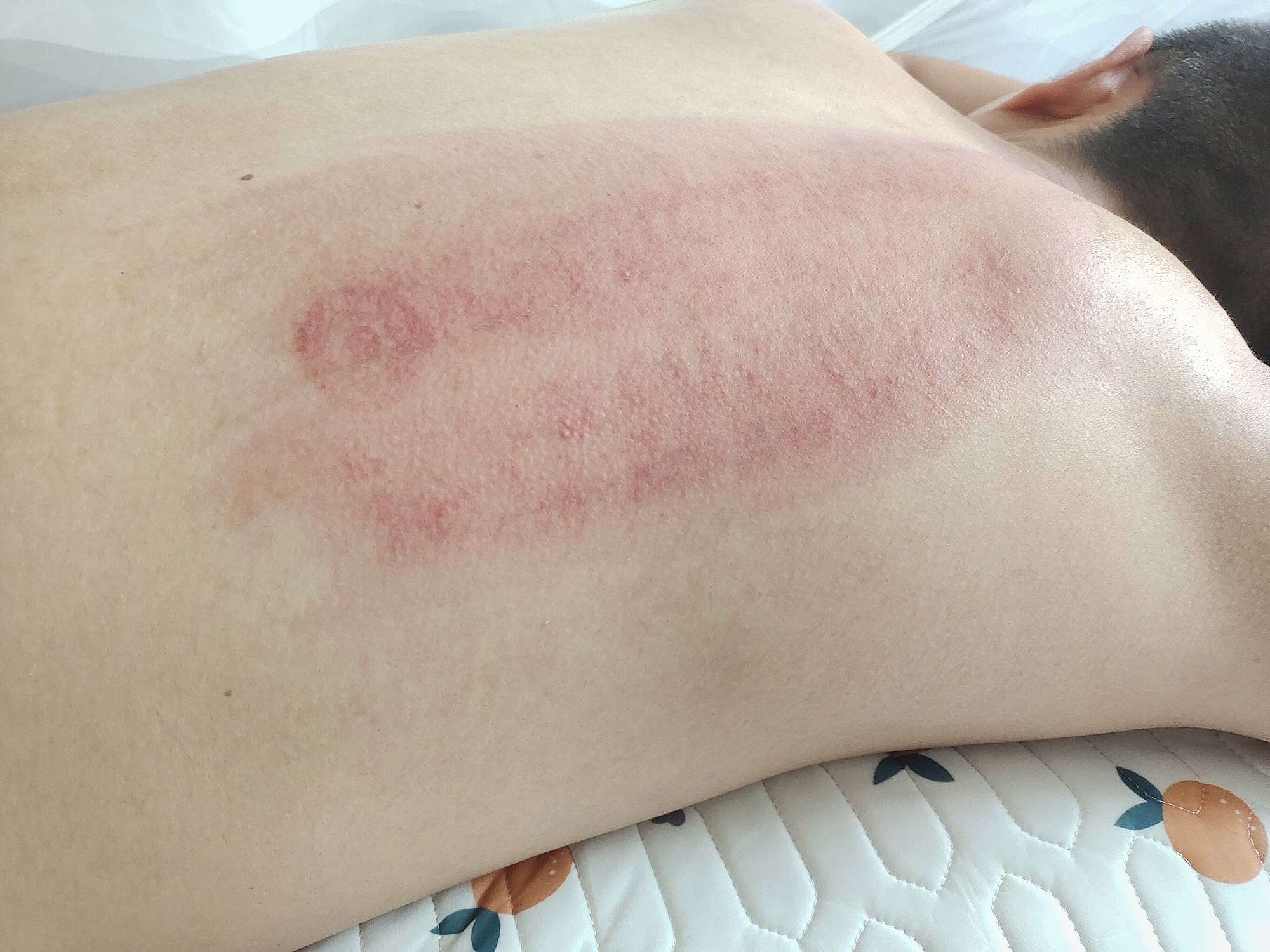 左点智能走罐刮痧器操作视频,电动走罐刮痧仪器的使用方法