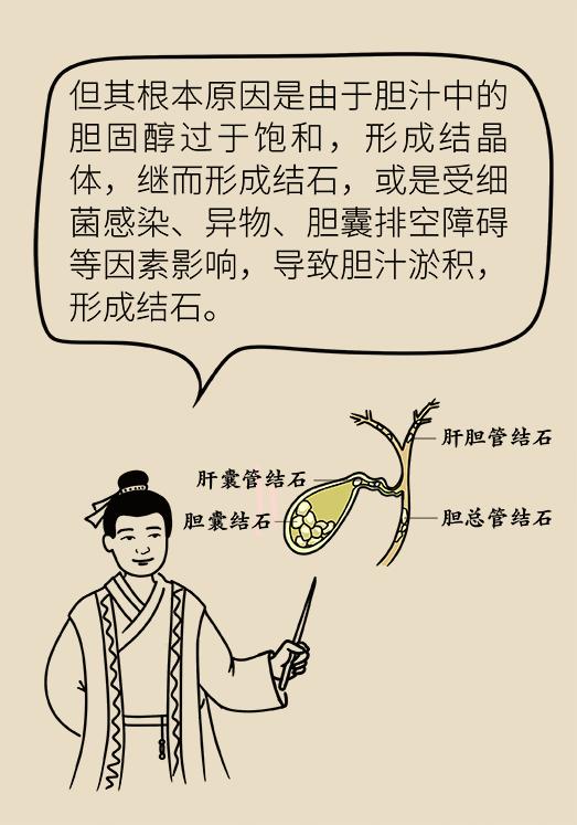 胆结石患者宜吃哪些食物,胆结石患者除了喝稀饭还能吃什么