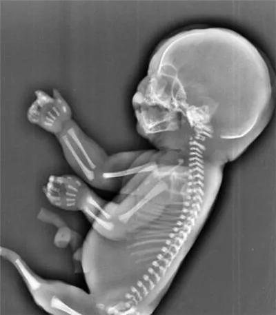 真实存在的美人鱼叫什么,真实存在的美人鱼解说