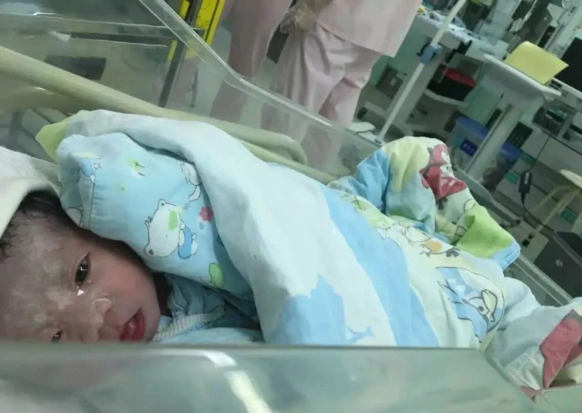 新生儿有点黑怎么办,刚出生的婴儿太黑怎么办