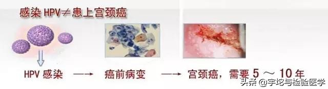 女性必知的七大宫颈癌风险因素,宫颈癌有哪些认识误区