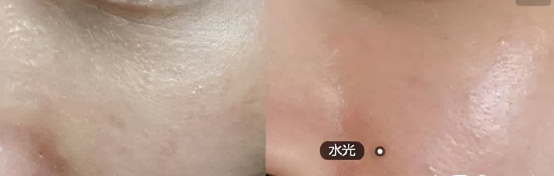 面部松弛下垂的最好解决办法,面部松弛下垂的最快恢复办法