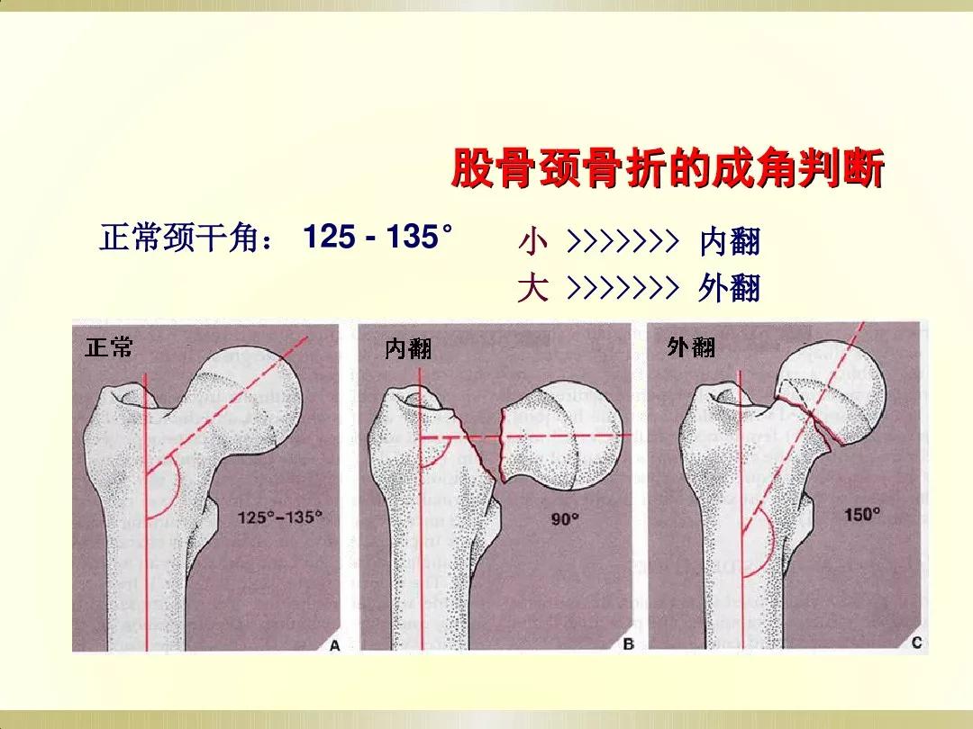 骨科x光片读片技巧,放射科骨科读片教程