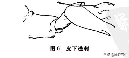 金针王乐亭全部视频,金针王乐亭徒弟