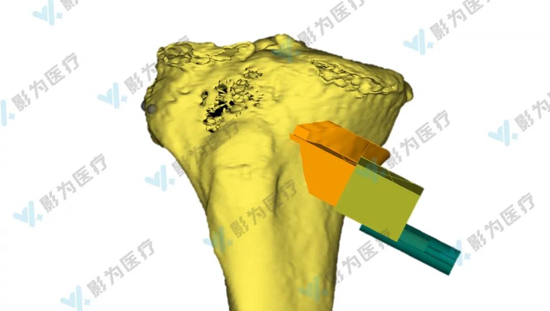 安医大阜阳附属医院减重,阜阳市颍州区安医大附属阜阳医院