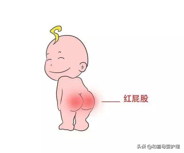 宝宝红屁股快速有效的方法,宝宝红屁股了怎么弄好得快