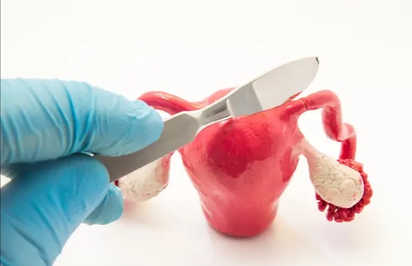 子宫感染病毒切不切子宫,子宫全切还会有什么病