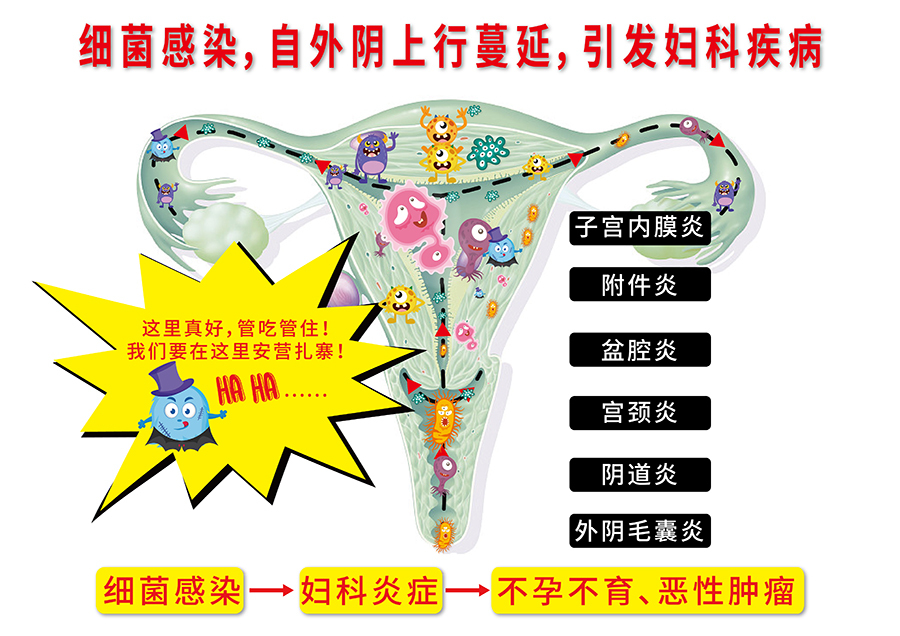 obb卫生巾哪种好,obb卫生巾是什么牌子