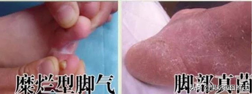 这颗风靡全世界的蛋，用着让人感觉好舒服