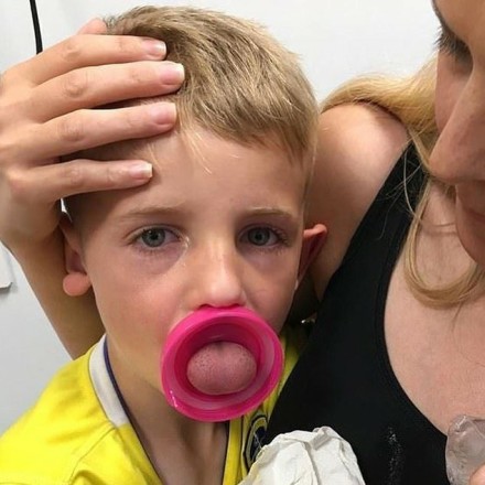 小孩子被划伤要不要打破伤风,6岁孩子被妈妈捅伤躲洗衣机