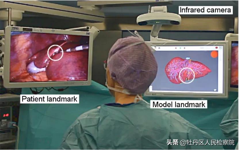 赵英俊肝癌做手术了吗,赵英俊肝癌做了手术没有