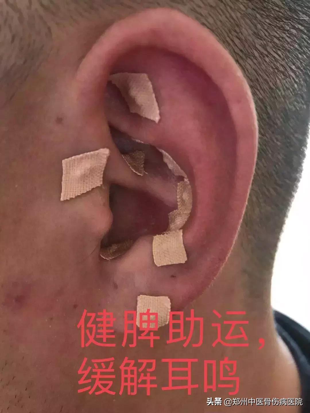 小耳朵大乾坤,耳穴的秘密中医