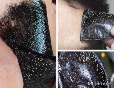 上门祛黑头粉刺,男士祛黑头推荐