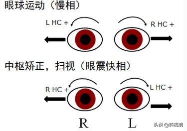孩子突然眼球震颤,如果孩子眼睛异常该怎么办