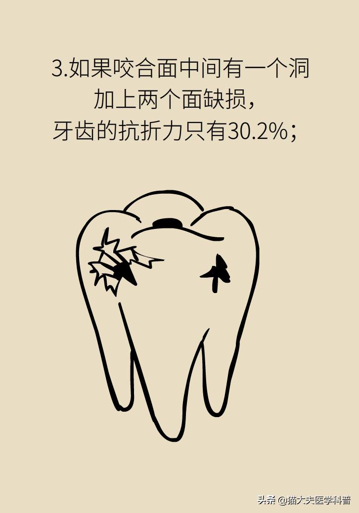杀死牙神经变成死牙了吗,杀牙神经到底好不好