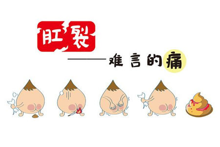 一岁宝宝肛裂后怎么排便,孩子便秘肛裂看什么科大便特别粗