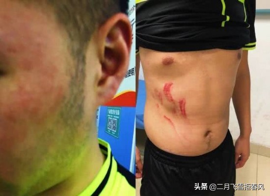 殴打足球裁判的下场,足球球迷殴打裁判