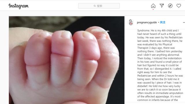 濡堝鍙戠幇瀛╁瓙鍏牴鑴氳毒,濡堝鑴氳毒鎴偄