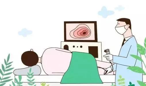 消化内科专家谈肠息肉,肠息肉应该在肠镜检查时切除吗