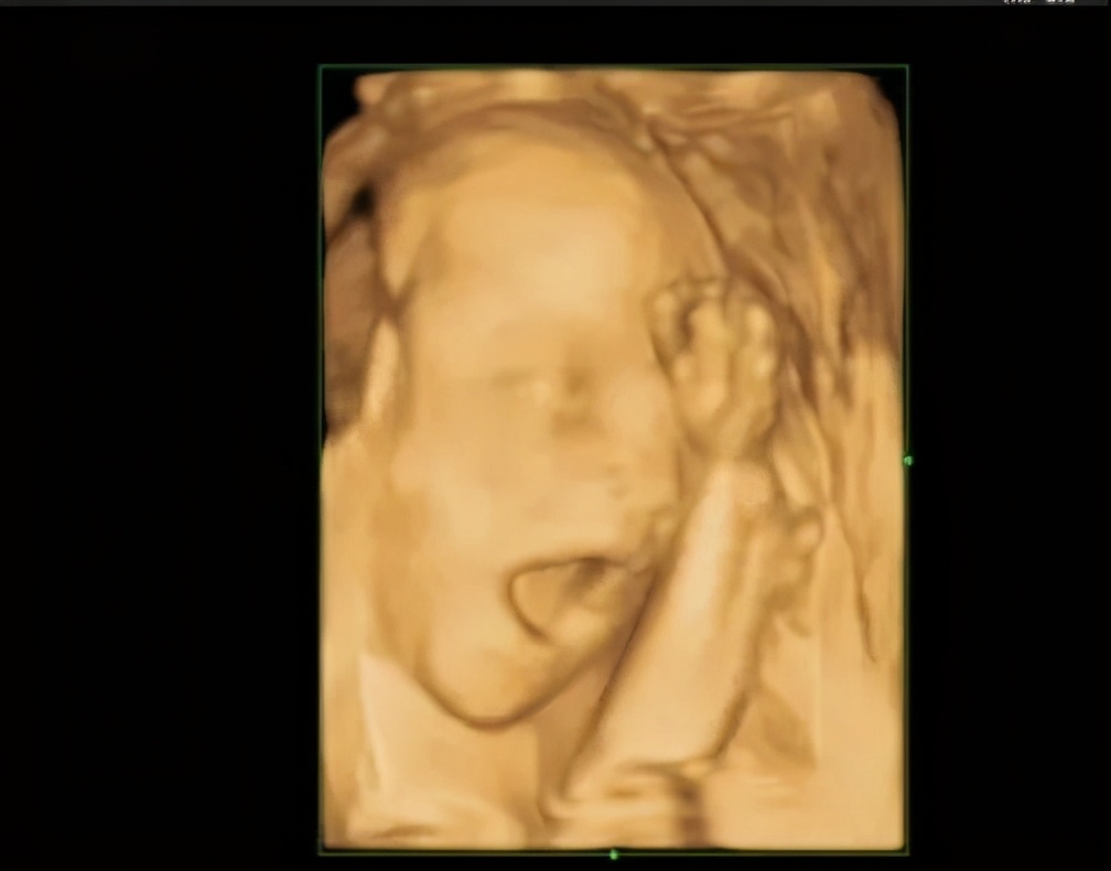 孕期检查做几次四维彩超,孕期产检需要做几次肝胆彩超