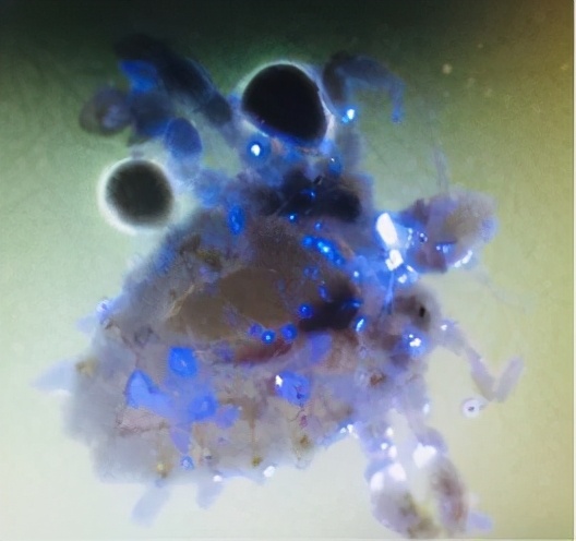 6岁孩子说眼睛痒眨眼怎么回事,小孩眼睛痒是有虫子吗