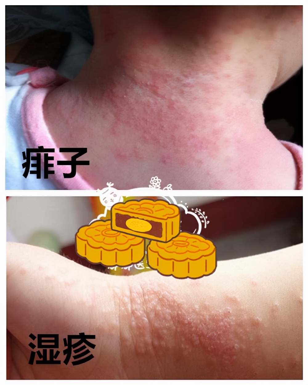 为什么现在孩子免疫力都差,小孩的免疫力到底是强还是弱