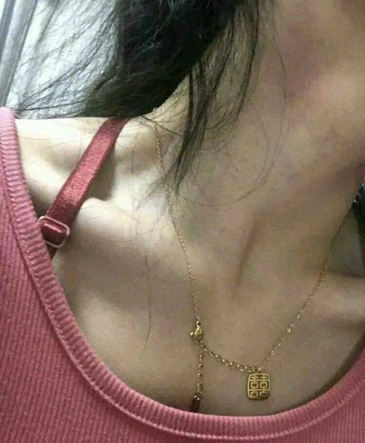 女朋友说她脖子上的红印是吃烤地瓜不小心烫到的，我是不是想多了