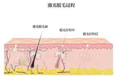 打美白针应注意的情况是哪些,打美白针的效果怎么样呢