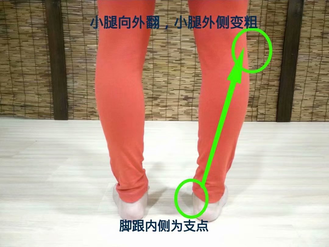 扁平足穿没有足底支撑的鞋,如何改善扁平足穿鞋的效果