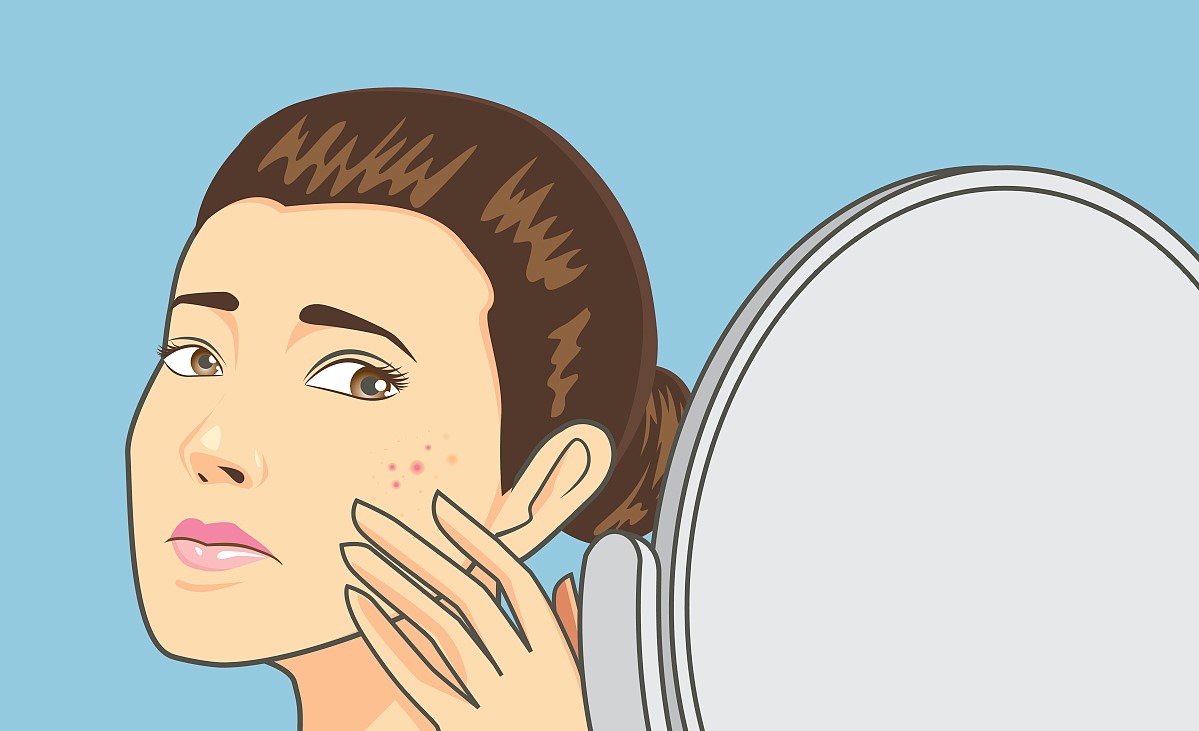 面部激素依赖性皮炎吃什么药,什么叫做面部激素依赖性皮炎