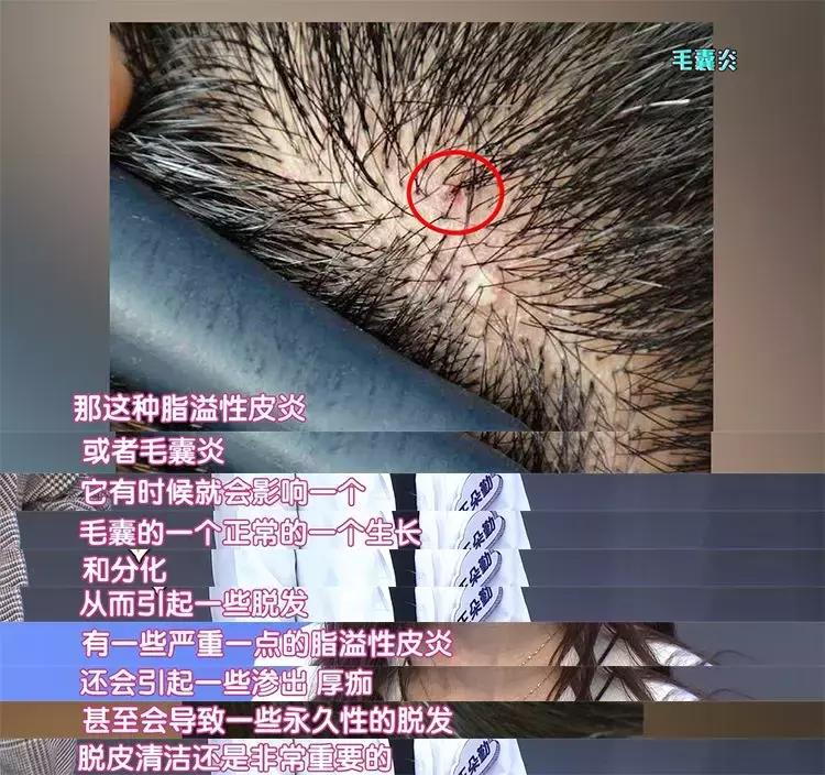 洗发水推荐控油蓬松樱花,claynal樱花洗发水推荐