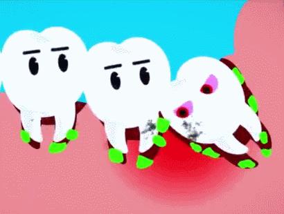 智齿未完全萌出要不要拔除,智齿有必要拔吗图片大全