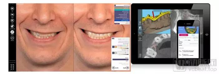 锐珂牙科医疗器械,锐珂医疗公司产品历程