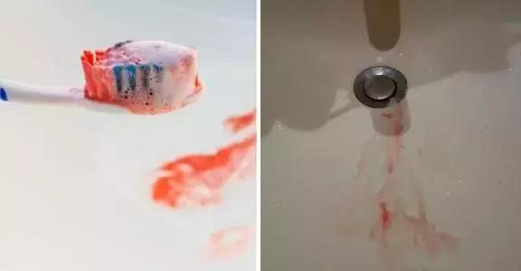 一口黄牙竟让形象尽毁！‘到手香’帮你重新找回自信！大胆开笑