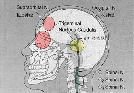 颈源性头痛培训试题,颈源性头痛的锻炼方法
