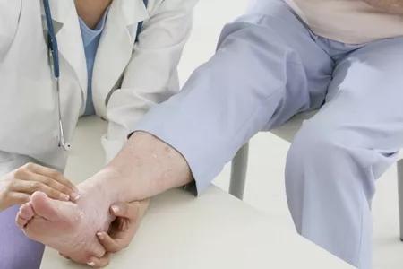 手指痛风的症状和治疗,尿酸高痛风症状的图片