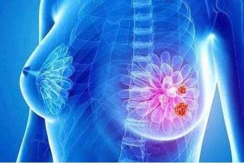 哺乳期乳房内长了一片小疙瘩,喂奶发现乳房有一个滚动的疙瘩