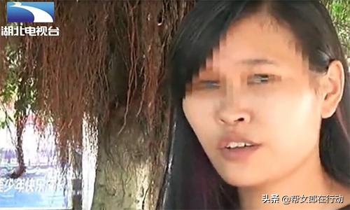 整形失败眼睛失明,女子微整形导致失明