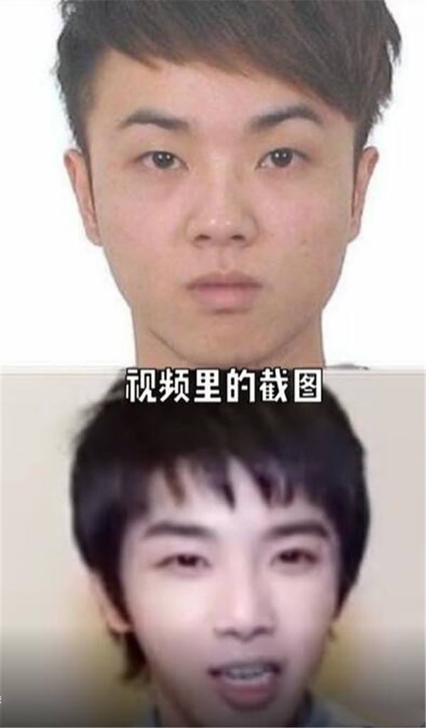 为什么华晨宇植发效果好,华晨宇植发图片是真的吗