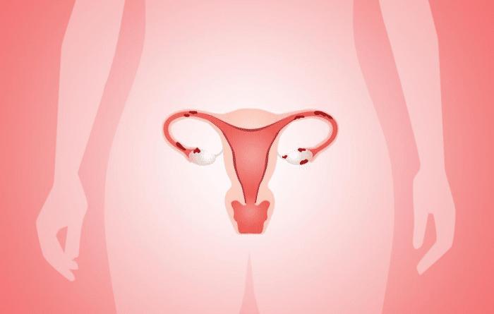 女人上了节育环会出现宫外孕吗,女人上了节育环